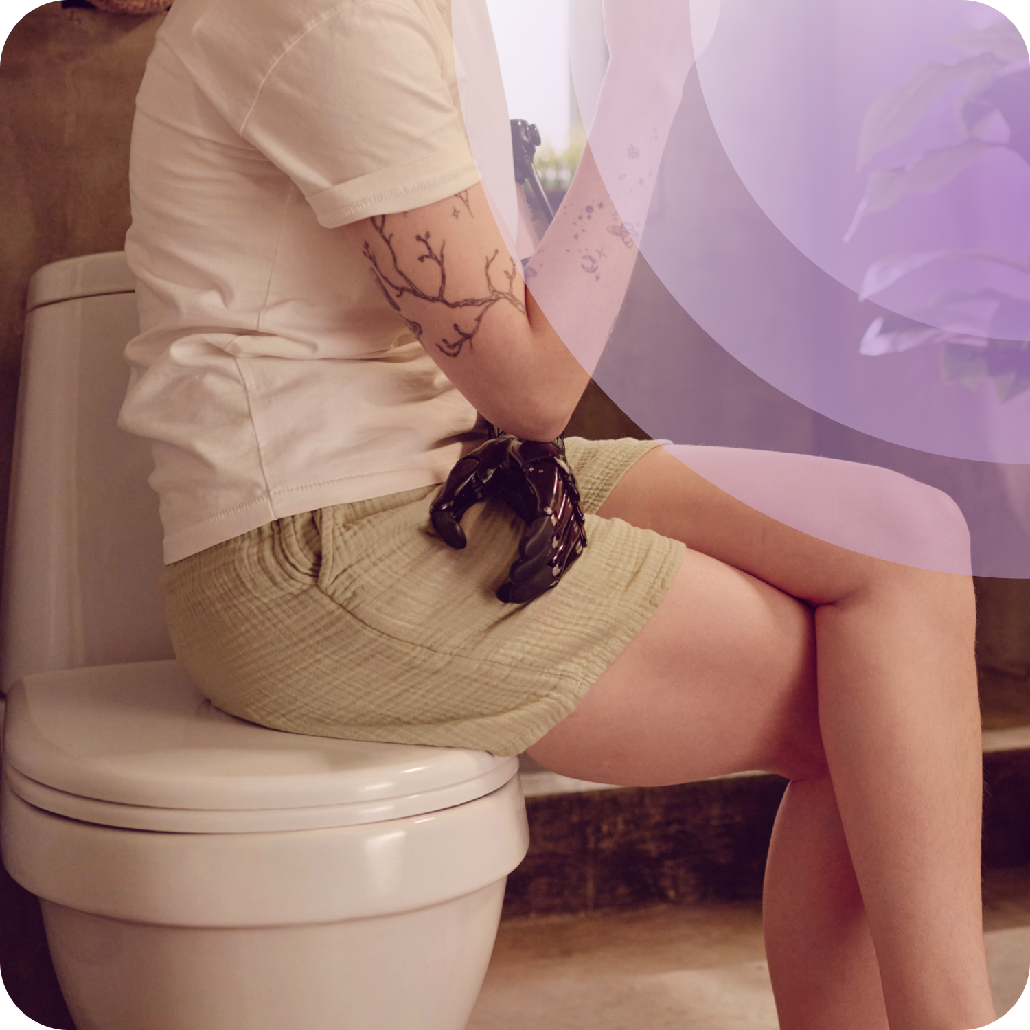 Illustrated overview of stress urinary incontinence